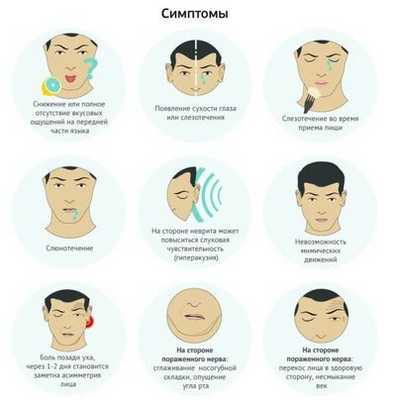 Симптомы неврита