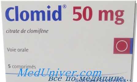 синдром гиперстимуляции яичников