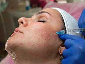 Гиалуроновая кислота для омоложения