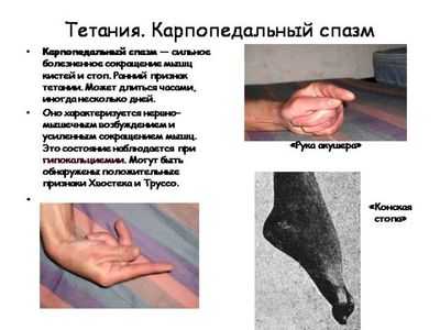 Детская тетания