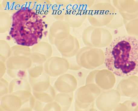 гипосенсебилизация