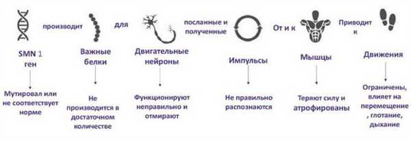 Спинальные амиотрофии