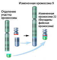 Хронический лейкоз