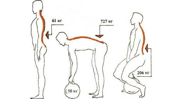 Так как осетофиты разрастаются из-за перегрузки спины, обратите внимание какие нагрузки испытывает позвоночник при разном положении тела