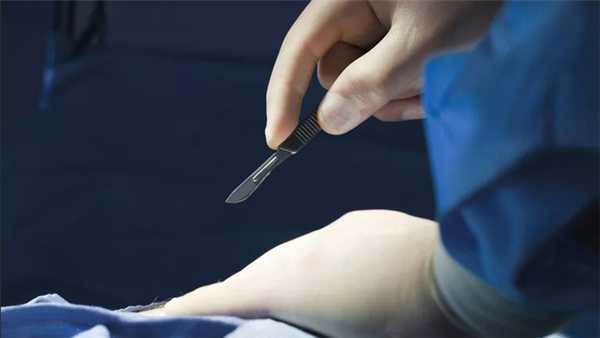 Хирургия кишечной непроходимости