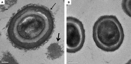 спора бактерии