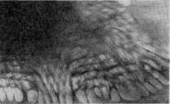 строение колпачка