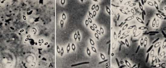 центрально расположенные споры бактерий