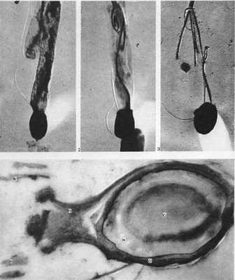 стадии спорообразования бактерий