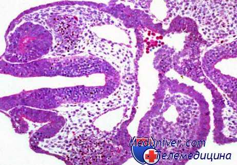 послеабортная септицемия