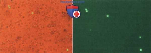 Перспективы применения контрастной эхокардиографии