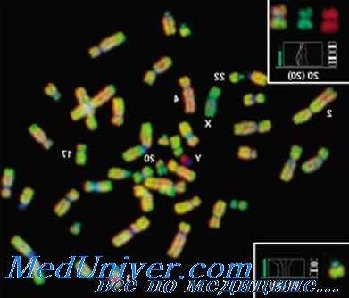 сравнительная геномная гибридизация