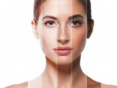 фототип кожи