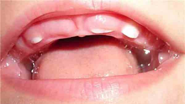 Время появления первых зубов