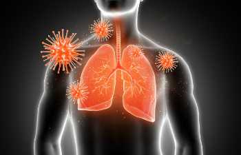 Симптомы стадий саркомы мягких тканей