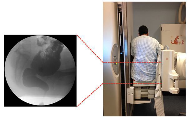 Дефекография [18]