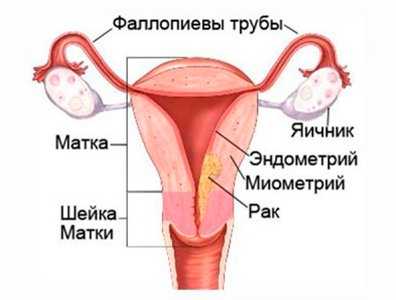 Аспирационная биопсия эндометрия и гистерорезектоскопия