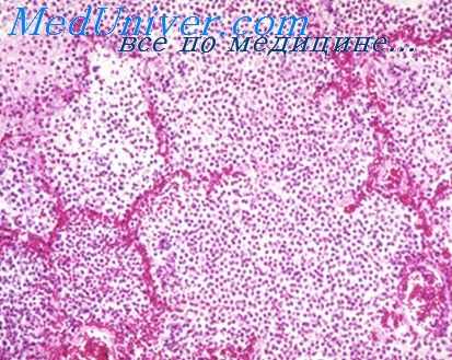 лимфатическая система легких