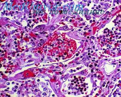 дыхательные пути