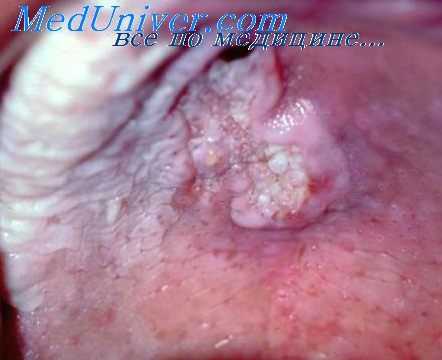 токсические действия пластмасс