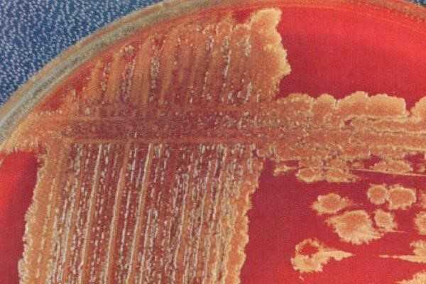 Стрептококки 1