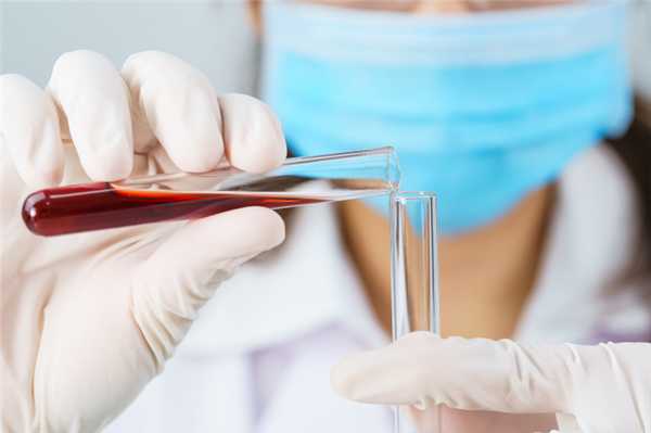 You are currently viewing Анализ на антистрептолизин - показания, нормы, расшифровка результата теста на АСЛ-О