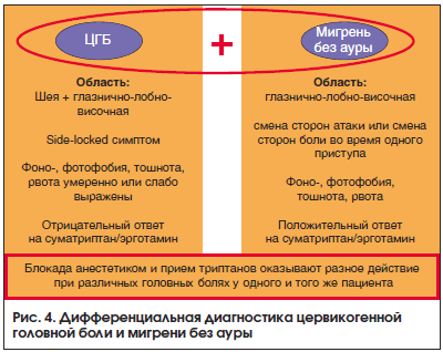Рис. 4. Дифференциальная диагностика цервикогенной головной боли и мигрени без ауры