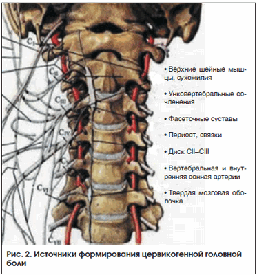 Рис. 2. Источники формирования цервикогенной головной боли