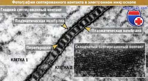 Септированный контакт
