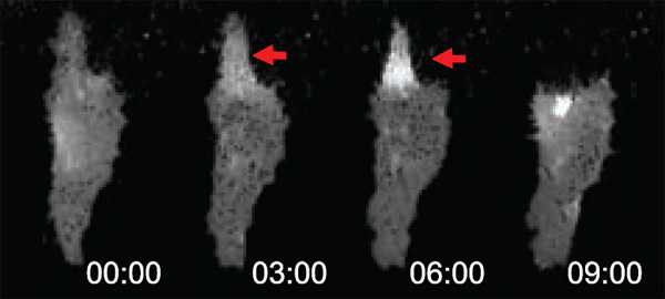 Под воздействием белка Wnt на одном из концов клетки меланомы формируется молекулярный комплекс W-RAMP (светлое пятно, отмеченное красной стрелкой). Вскоре после этого, на 9-й минуте эксперимента, происходит втягивание мембраны. Фото из обсуждаемой статьи в Science