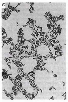 Строение бактерий. Клеточная стенка бактерий.