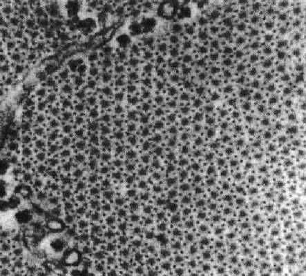 Решетчатая структура филаментов актина и миозина (H.E. Huxley, 1972)