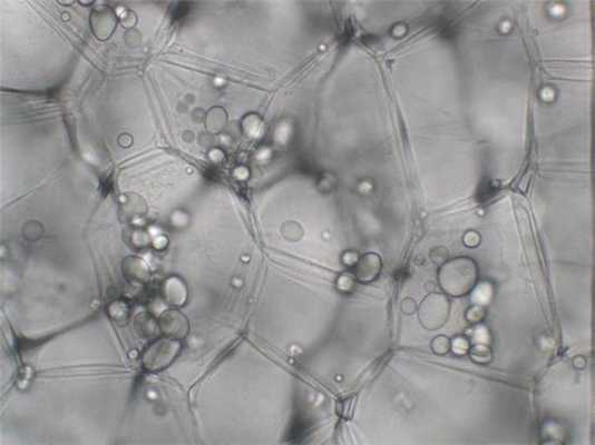 Бесцветные лейкопласты