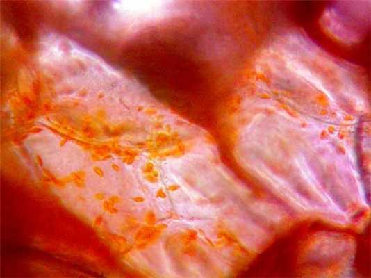 Разноцветные хромопласты