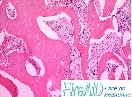 Строма костного мозга. Роль стромы костного мозга в регуляции кроветворения.