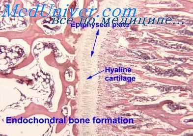 трансплантация костного мозга