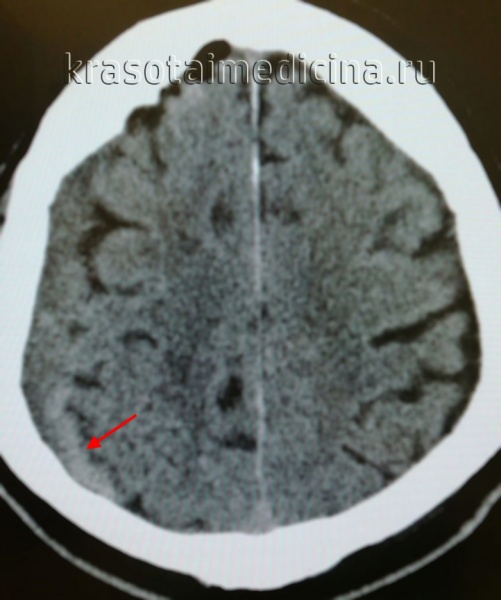 Яковлев Дмитрий Вячеславович, нейрохирург - Белгород