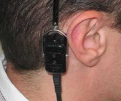 Рисунок 5. Расположение костного телефона за ушной раковиной на сосцевидном отростке височной кости при измерении порогов слышимости костно проведенных звуков.