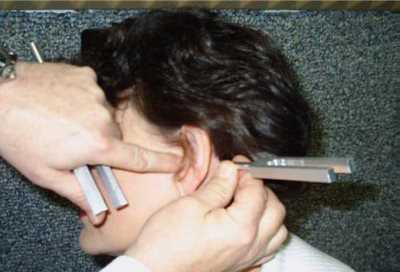 Рисунок 1. Камертональный опыт Бинга