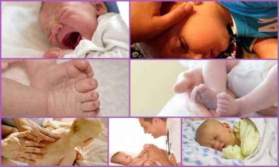 Другие виды судорог у новорожденного