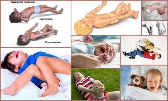 Судороги у детей - разновидности