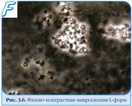 Хроническая инфекция. Медленные инфекции. Персистирующие инфекции.