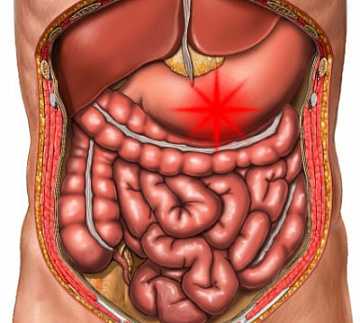 Фото Стеноз кишки