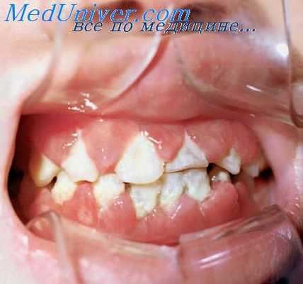 полость рта