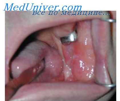 полость рта