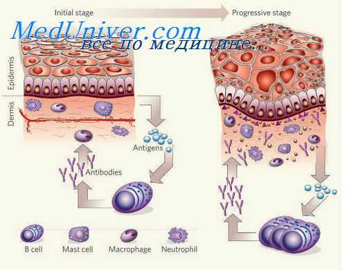 воспаление при вирусной инфекции