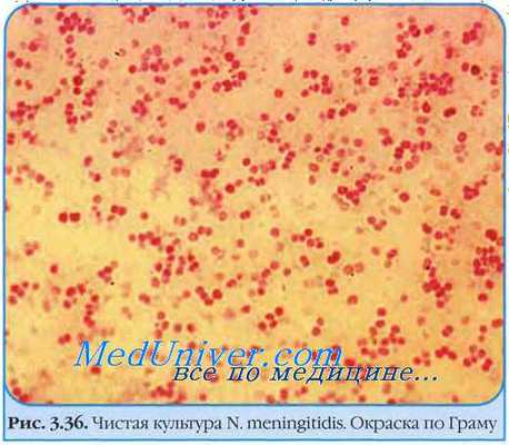 Менингококк (Neisseria menengitidis)