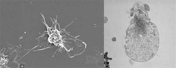 Обычные активированные тромбоциты и сверхактивированные, или прокоагулянтные, тромбоциты. Фото Михаила Пантелеева, МГУ. («Наука и жизнь» №10, 2016)
