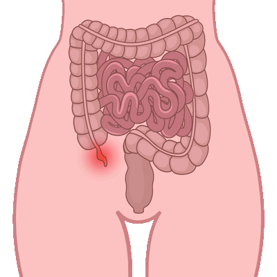 Тупая травма живота