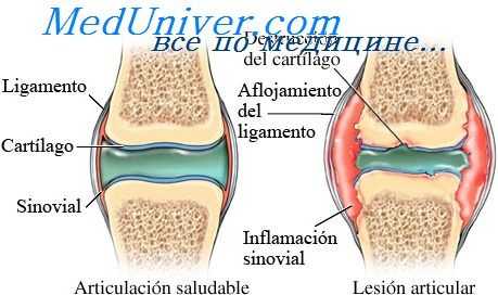 пальпация суставов